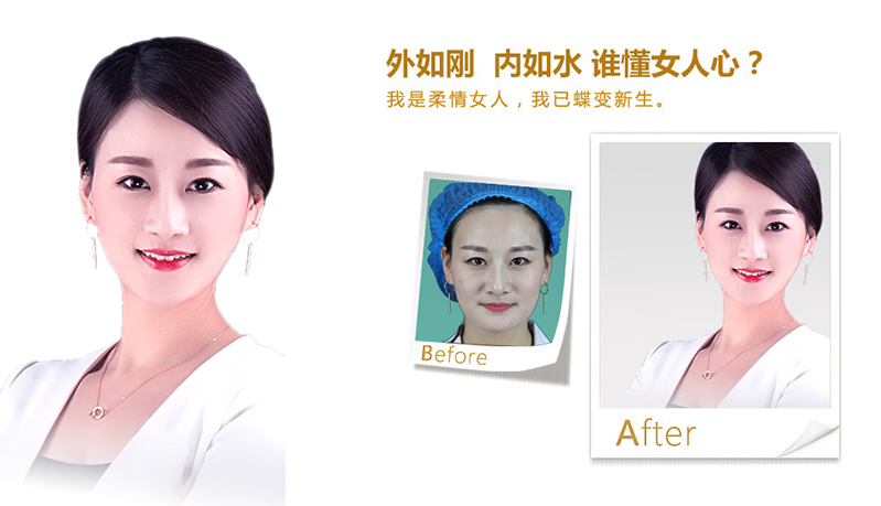 泰安V脸、线雕隆鼻
